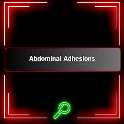 BHTV-Reports: Abdominal Adhesions