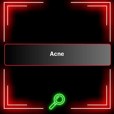 BHTV-Reports: Acne